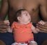 U.S. CDC Study Concludes Zika Can Cause Microcephaly